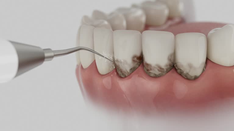 Trusted Root Canal Treatment service in Crawfordville, FL - Dentist Open Now
